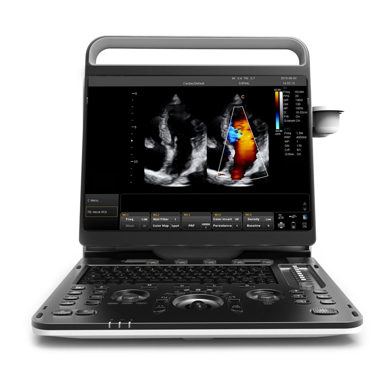 Chison Ebit50 4D 5D Portable Color Doppler Digital Dianostic Imaging System Human Ultrasound Gynecology, Cardiovascular Echo Machine